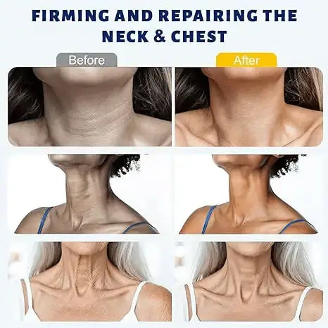 Softanas™ Instant Neck Lift Cream