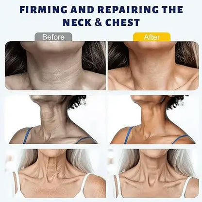 Softanas™ Instant Neck Lift Cream