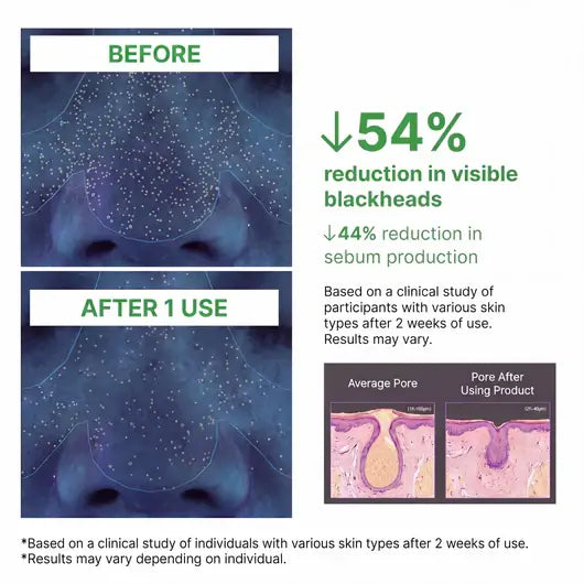 Softanas™ - Holy Basil Bubble Deep Mask
