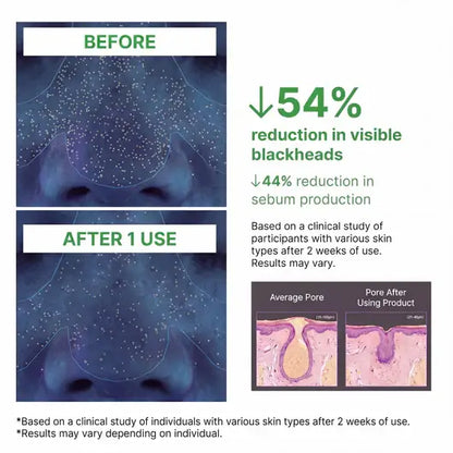 Softanas™ - Holy Basil Bubble Deep Mask