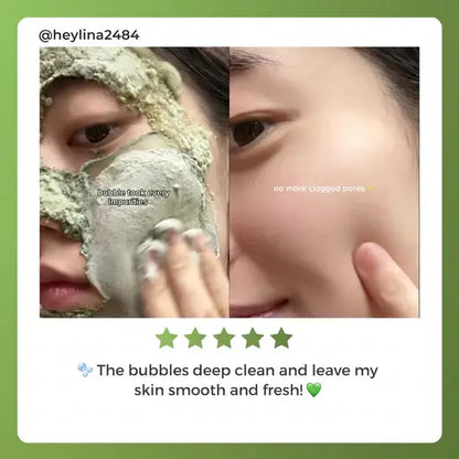 Softanas™ - Holy Basil Bubble Deep Mask