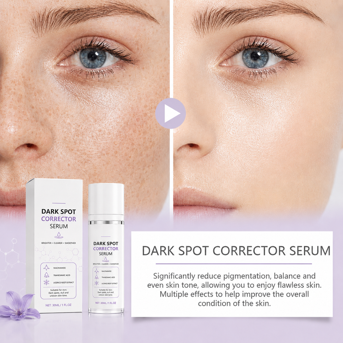 🔥Limited Time Offer🔥Advanced Dark Spot Corrector Serum -Multi-Correction Brightening Formulafor Sun Spots, Age Spots, and Melasma