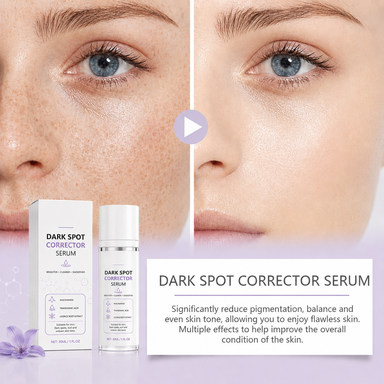 🔥Limited Time Offer🔥Advanced Dark Spot Corrector Serum -Multi-Correction Brightening Formulafor Sun Spots, Age Spots, and Melasma