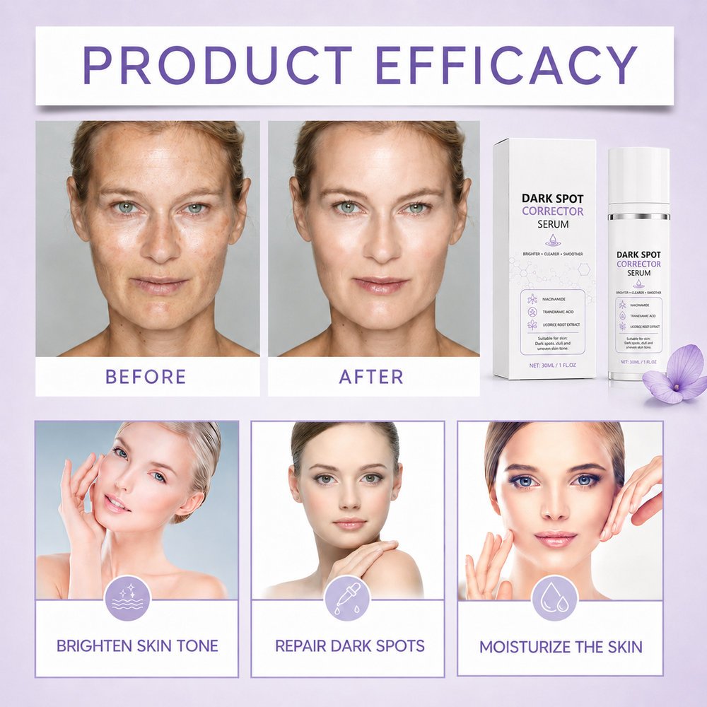 🔥Limited Time Offer🔥Advanced Dark Spot Corrector Serum -Multi-Correction Brightening Formulafor Sun Spots, Age Spots, and Melasma