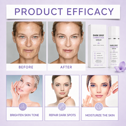🔥Limited Time Offer🔥Advanced Dark Spot Corrector Serum -Multi-Correction Brightening Formulafor Sun Spots, Age Spots, and Melasma