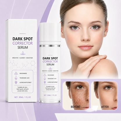 🔥Limited Time Offer🔥Advanced Dark Spot Corrector Serum -Multi-Correction Brightening Formulafor Sun Spots, Age Spots, and Melasma
